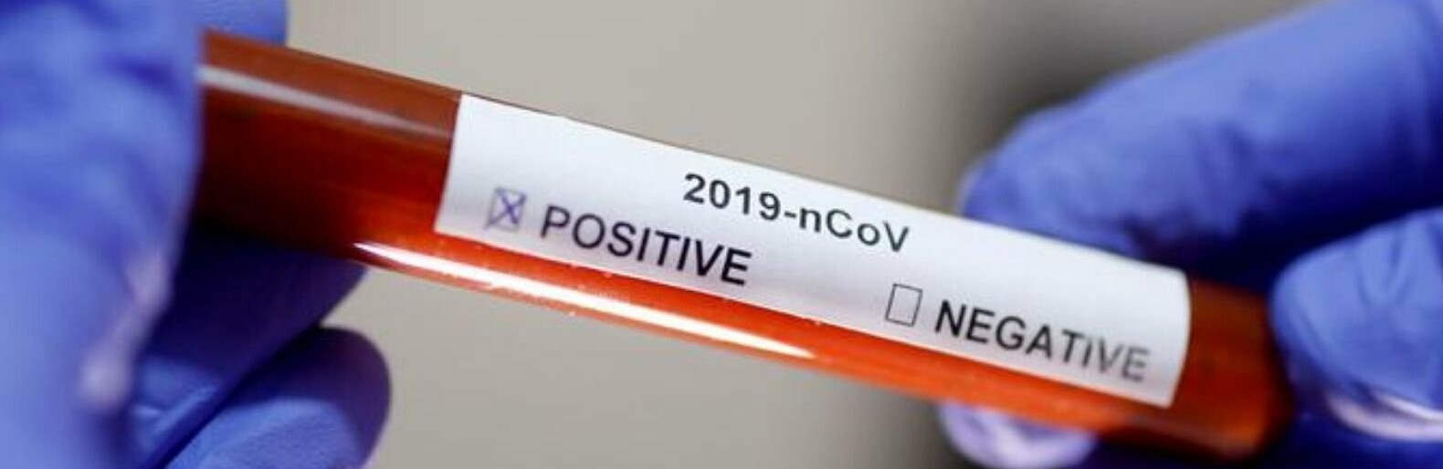  ������� ������������� 1462 ������ ��������� covid 