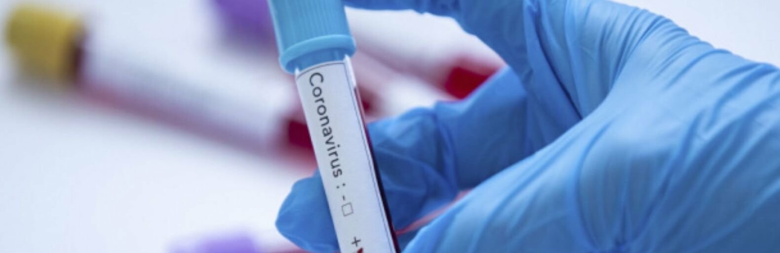  ������������ ������� ��������������� ������ ��������� covid-19 