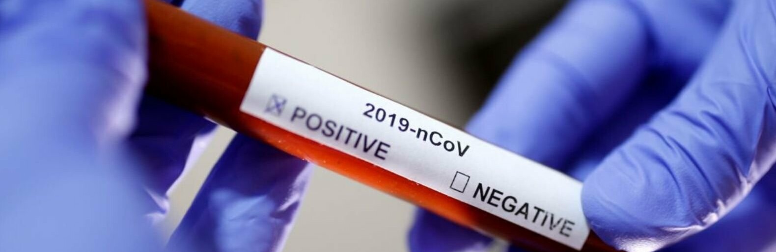  ������������ ������������� ������� ��������� ������������� ���� 