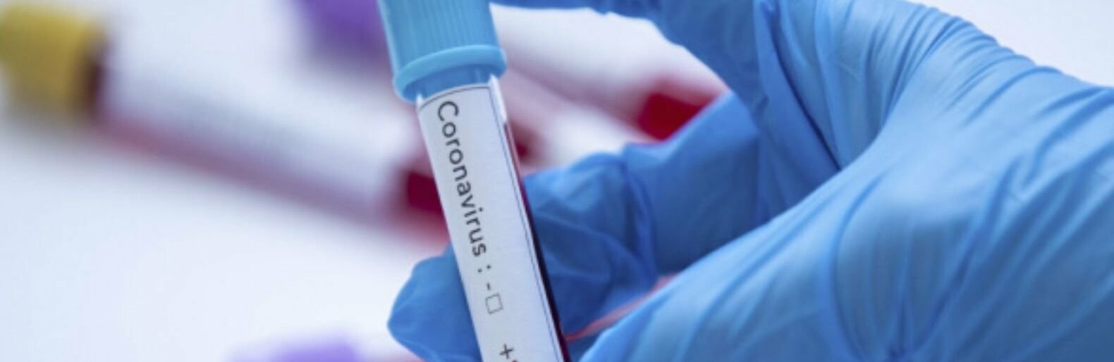  ������� ������������� 847 ������� �������������� ������� covid-19 ���� 