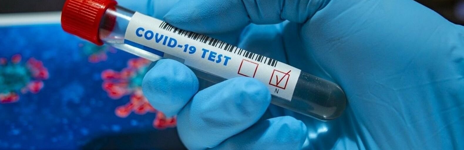  ������� ���������� ���������� covid-19 ����� ���������� ������ 