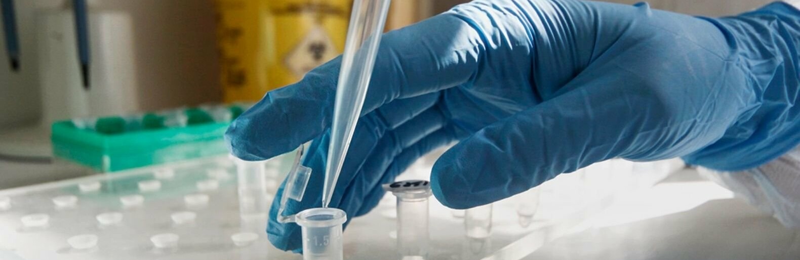  ����������� ����� ����� ���������� ���� covid-19 