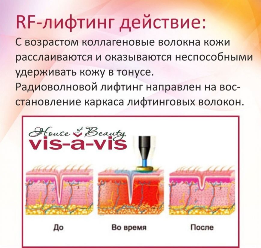 qRZ2TFVkl-s