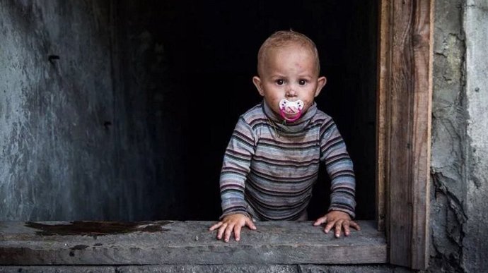 На Миколаївщині збільшилася кількість постраждалих дітей від збройної агресії рашистів