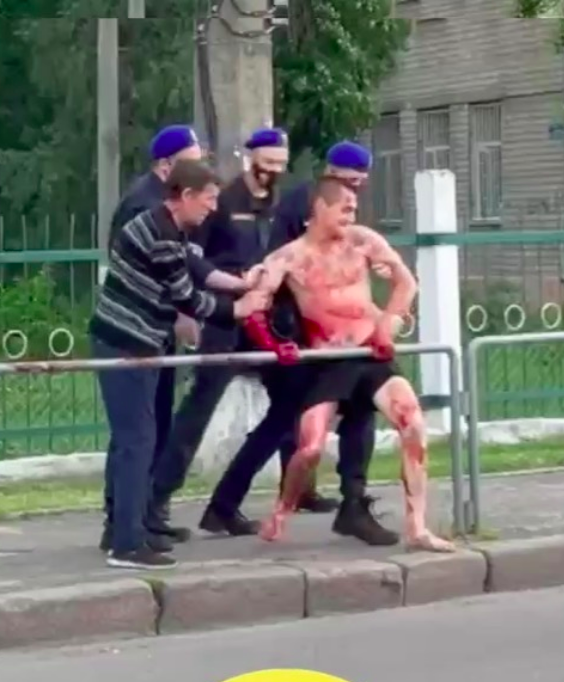 В Николаеве пытались успокоить полуголого окровавленного мужчину, кидавшегося на нацгвардию и медиков, - ВИДЕО