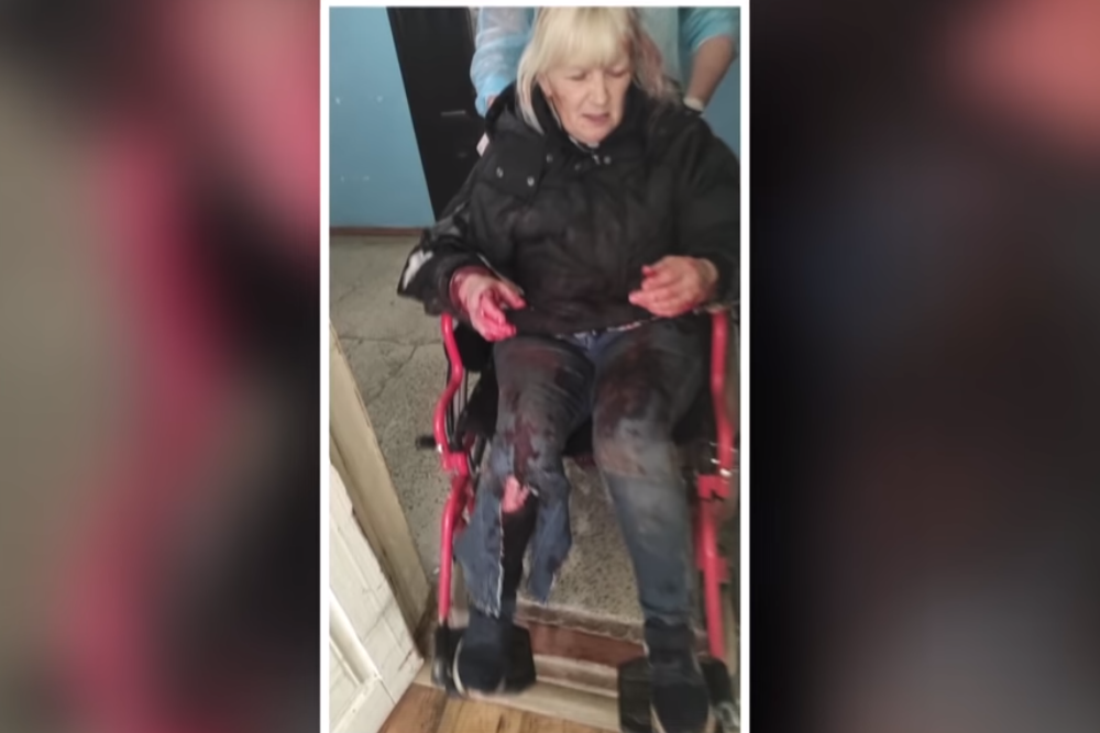 В Новой Одессе бешенная собака укусила женщин