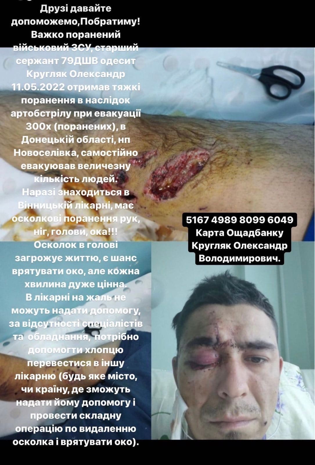 Боєць Миколаївської десантно-штурмової бригади потребує допомоги, - ФОТО