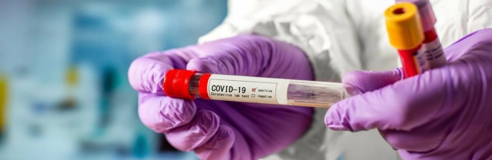 355 выздоровевших: статистика по COVID-19 в Николаевской области