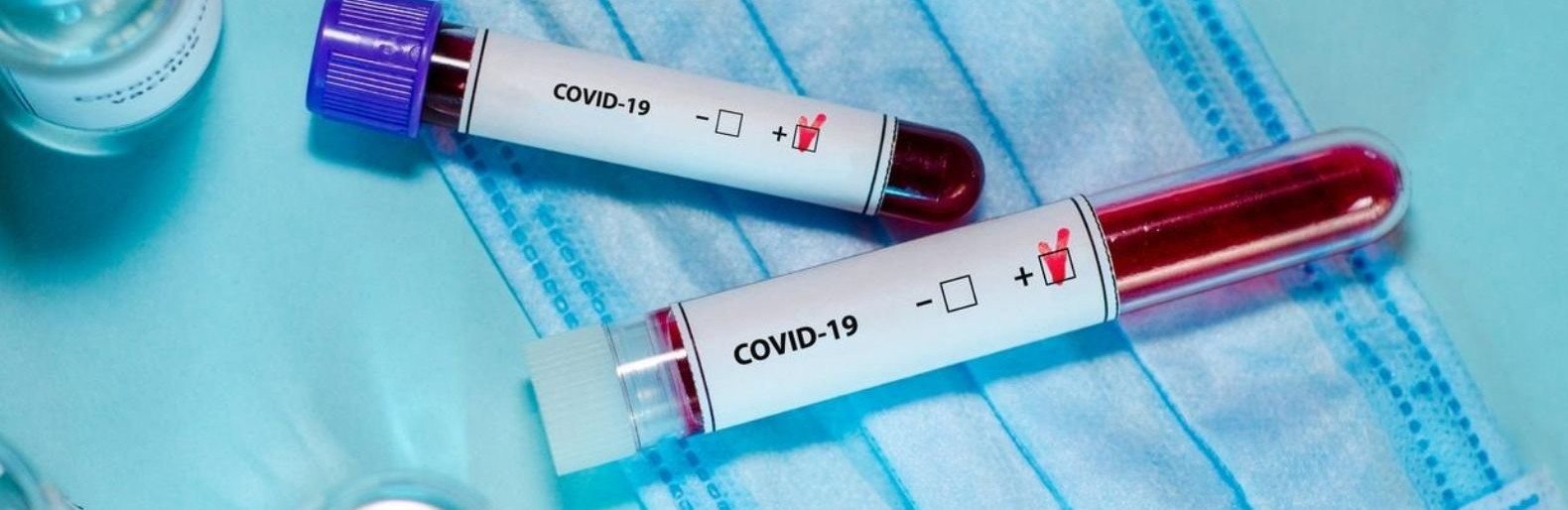 Выздоровело больше, чем заболело: свежая статистика по COVID-19 в Украине