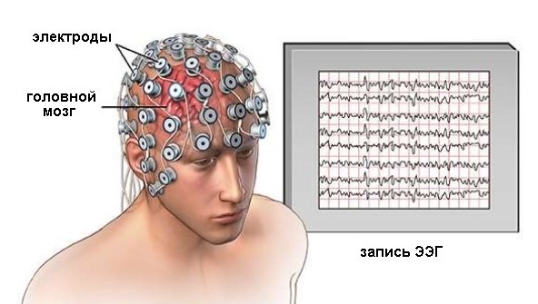 eeg